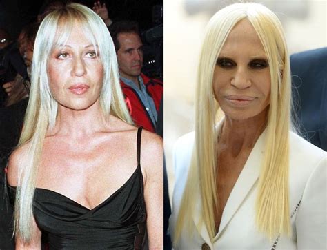 donatella versace wedding dress|donatella before and after.